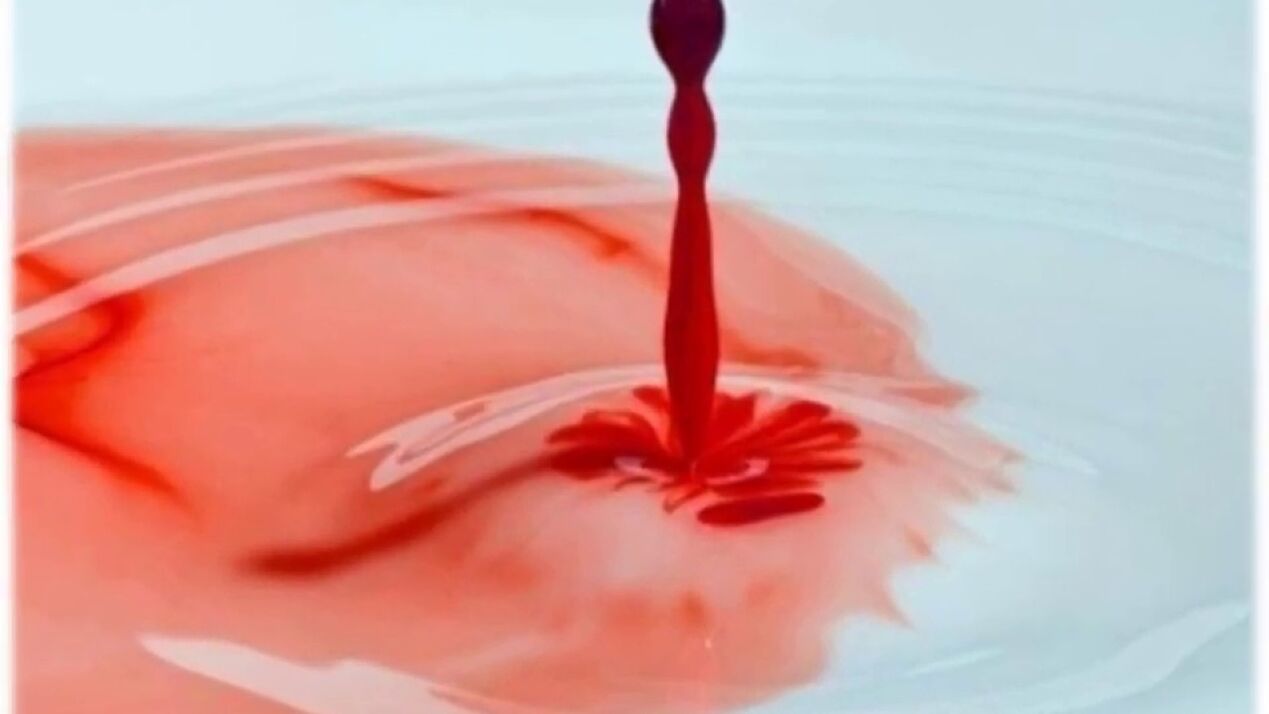 blutiger Ausfluss aus dem Penis