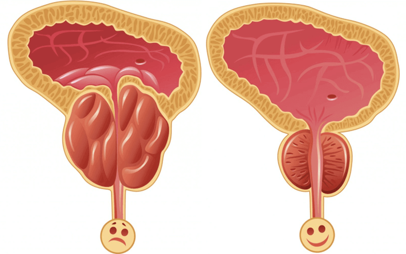 Ursachen für Potenzprobleme beim Mann